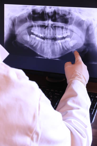Best Emergency Tooth Extraction in Terrell, TX