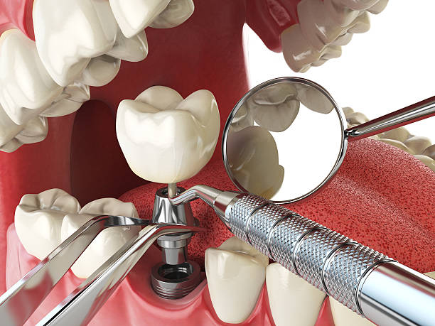 Best Emergency Dental Surgery in Terrell, TX