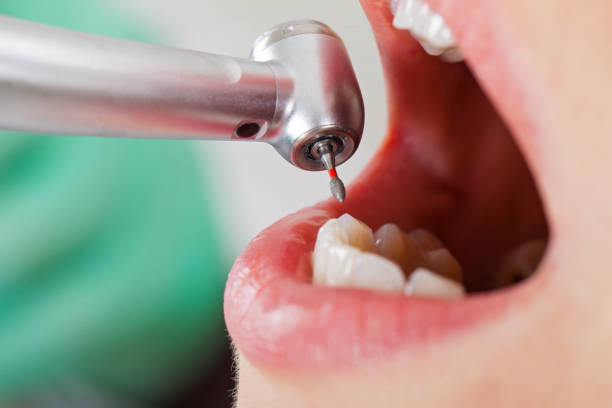 Best Pediatric Emergency Dentist in Terrell, TX